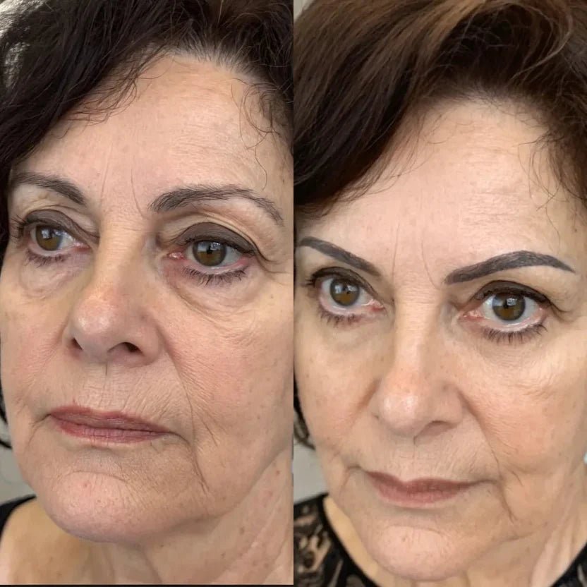 Soléva ReviveEyes™ - Soleva