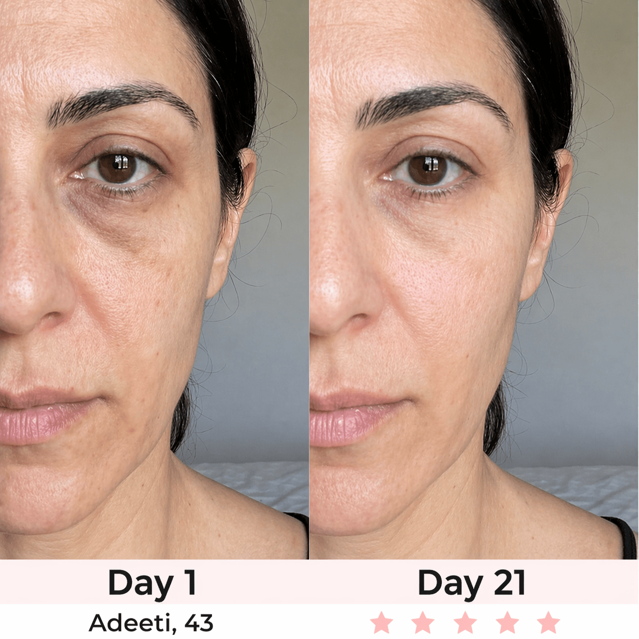 Soléva ReviveEyes™ - Soleva